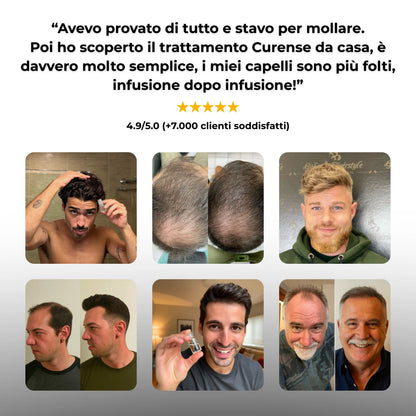 testimonianze ricrescita capelli