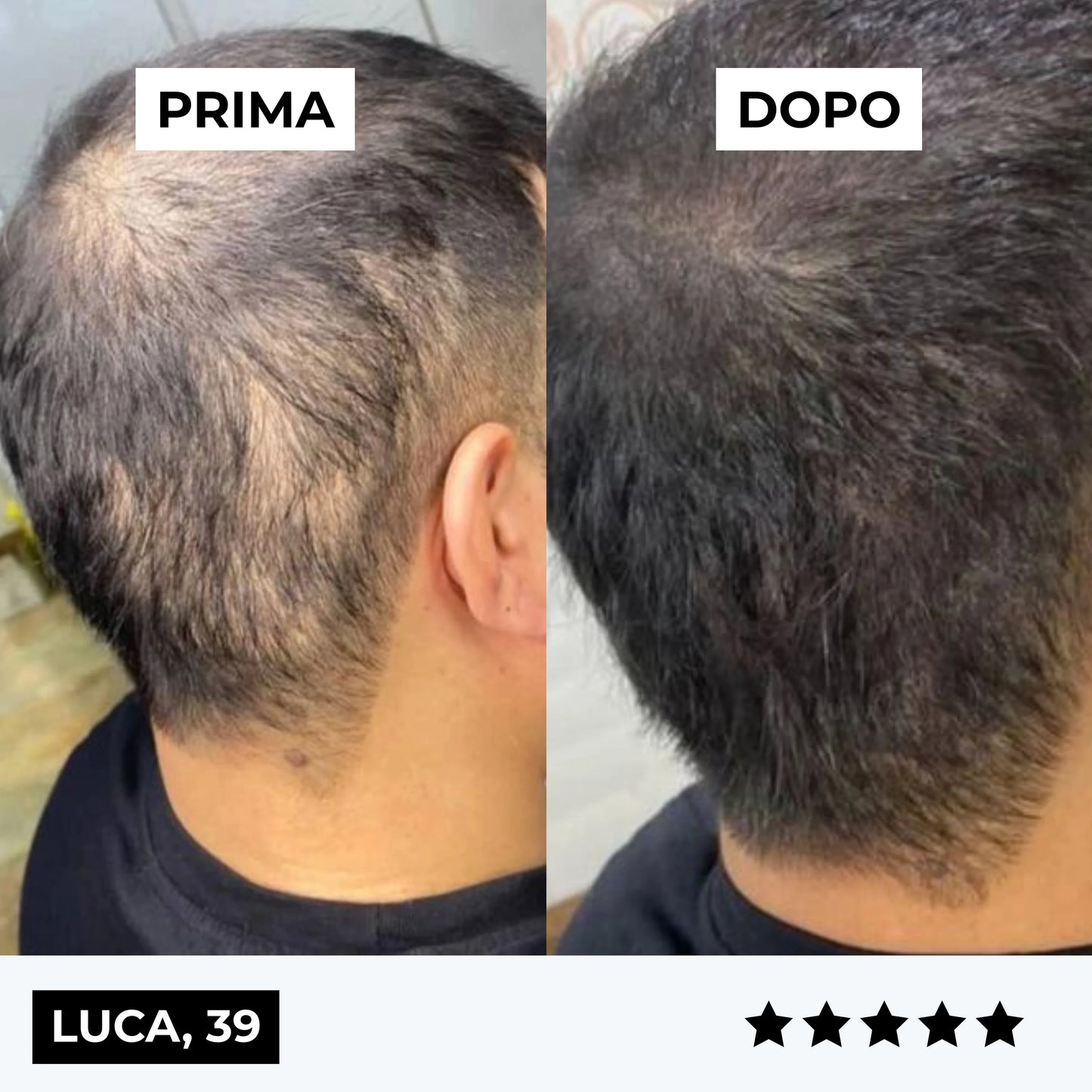 ricrescita capelli