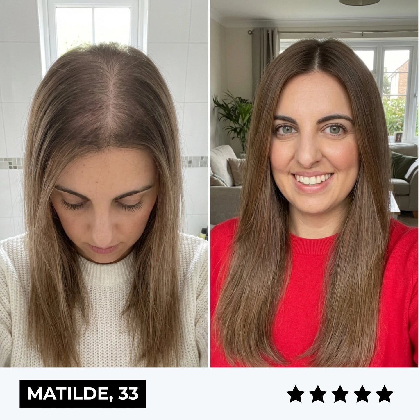 CURENSE - Sistema di micro-infusione per la ricrescita dei capelli