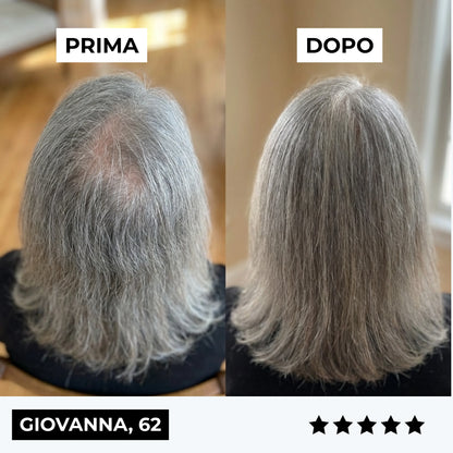 CURENSE - Sistema di micro-infusione per la ricrescita dei capelli