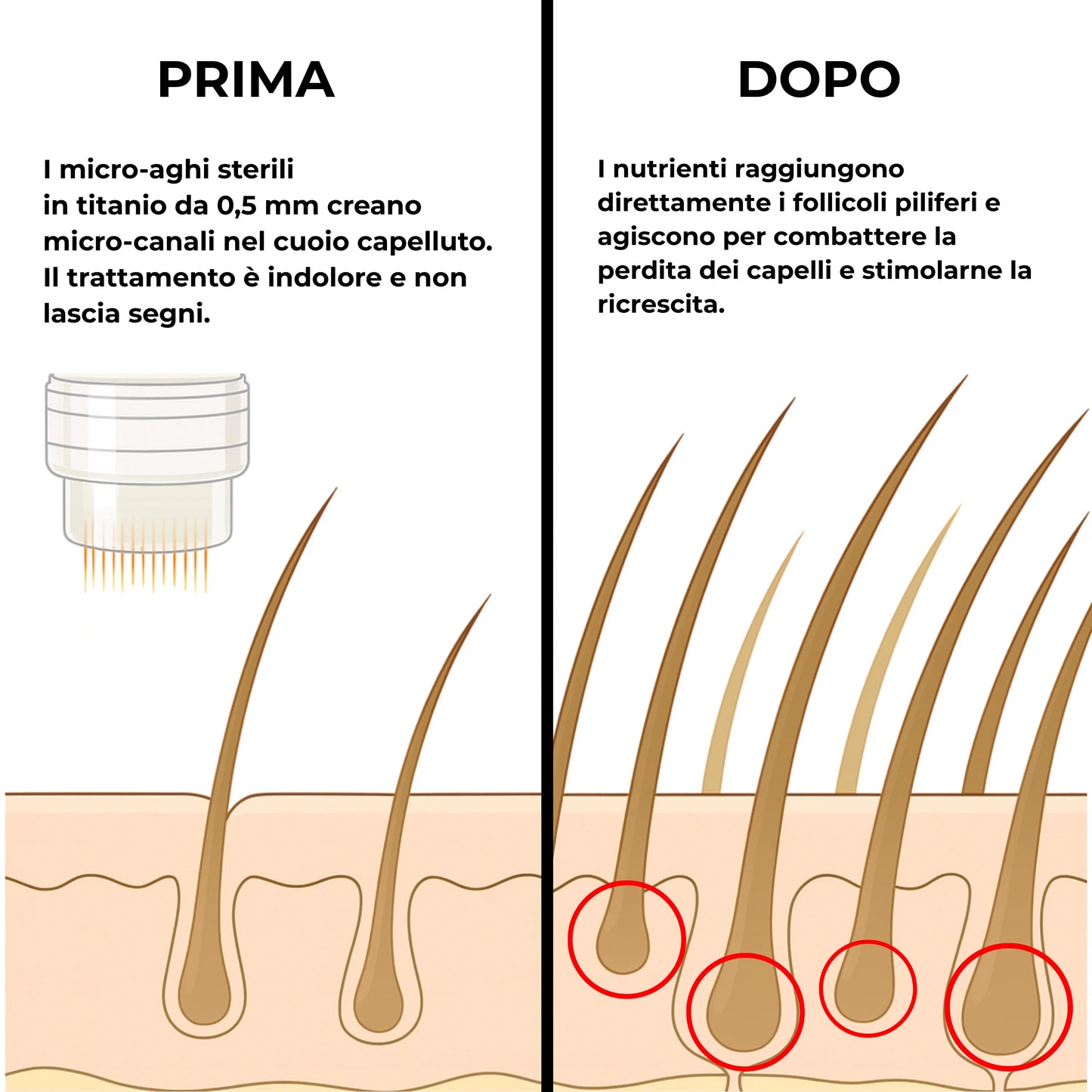 microaghi trattamento anticaduta e ricrescita capelli
